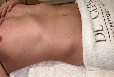 dainage lymphatique 2