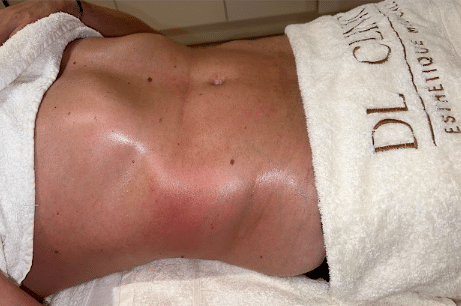 dainage lymphatique 2